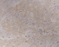 Invitrogen GRAMD1A Monoclonal Antibody (1-E4) 100 &mu;L | Buy Online | Invitrogen&trade; | Fisher Scientific