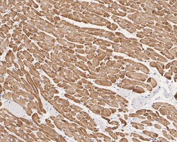 Invitrogen alpha-Cardiac Actin Monoclonal Antibody (33-32) 100 &mu;L; Unconjugated:Antibodies,