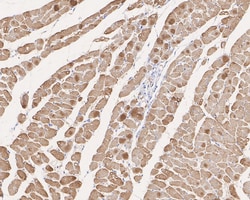 Invitrogen alpha-Cardiac Actin Monoclonal Antibody (33-32) 100 &mu;L; Unconjugated:Antibodies,