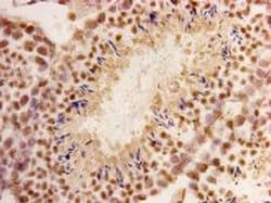 Invitrogen CHD1 Monoclonal Antibody (2-2) 100 &mu;L; Unconjugated:Antibodies,