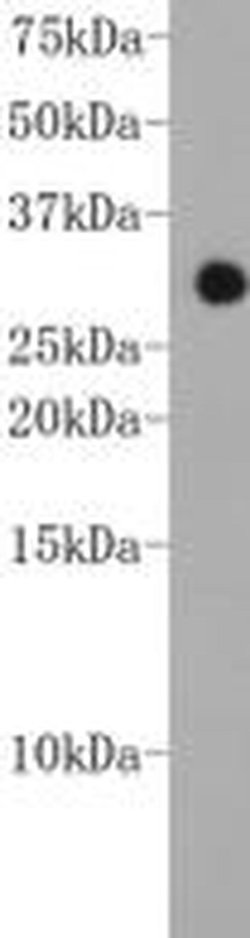 Invitrogen CHD1 Monoclonal Antibody (2-2) 100 &mu;L; Unconjugated:Antibodies,