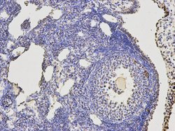 Invitrogen KLDC3 Monoclonal Antibody (A8-E8) 100 &mu;L | Buy Online | Invitrogen&trade; | Fisher Scientific