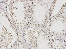 Invitrogen KLDC3 Monoclonal Antibody (A8-E8) 100 &mu;L | Buy Online | Invitrogen&trade; | Fisher Scientific