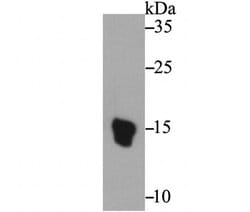 Invitrogen Axl Monoclonal Antibody (C4-A8) 100 &mu;L; Unconjugated:Antibodies,