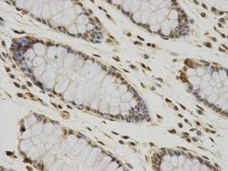Invitrogen CCDC111 Monoclonal Antibody (10-B3) 100 &mu;L; Unconjugated:Antibodies,