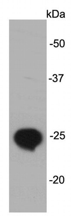 Invitrogen LIN28B Monoclonal Antibody (A2-4-5) 100 &mu;L; Unconjugated:Antibodies,