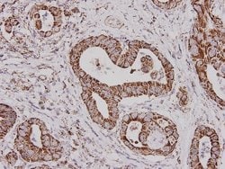 Invitrogen ALDH2 Monoclonal Antibody (7-D8) 100 &mu;L; Unconjugated:Antibodies,