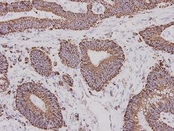 Invitrogen ALDH2 Monoclonal Antibody (7-D8) 100 &mu;L; Unconjugated:Antibodies,