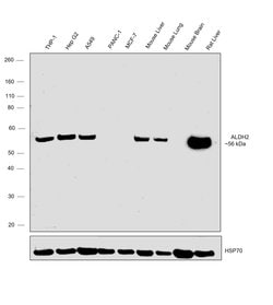 Invitrogen ALDH2 Monoclonal Antibody (7-D8) 100 &mu;L; Unconjugated:Antibodies,