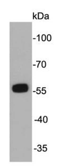 Invitrogen ALDH2 Monoclonal Antibody (7-D8) 100 &mu;L; Unconjugated:Antibodies,