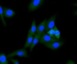 Invitrogen ALDH2 Monoclonal Antibody (E4-D10) 100 &mu;L; Unconjugated:Antibodies,
