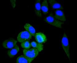 Invitrogen ALDH2 Monoclonal Antibody (E4-D10) 100 &mu;L; Unconjugated:Antibodies,