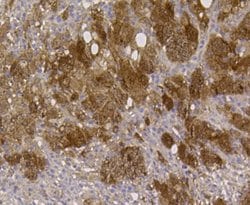 Invitrogen ALDH2 Monoclonal Antibody (E4-D10) 100 &mu;L; Unconjugated:Antibodies,