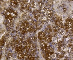 Invitrogen ALDH2 Monoclonal Antibody (E4-D10) 100 &mu;L; Unconjugated:Antibodies,