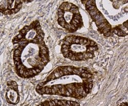 Invitrogen ALDH2 Monoclonal Antibody (E4-D10) 100 &mu;L; Unconjugated:Antibodies,