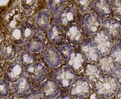 Invitrogen ALDH2 Monoclonal Antibody (E4-D10) 100 &mu;L; Unconjugated:Antibodies,
