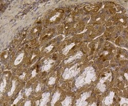 Invitrogen ALDH2 Monoclonal Antibody (E4-D10) 100 &mu;L; Unconjugated:Antibodies,