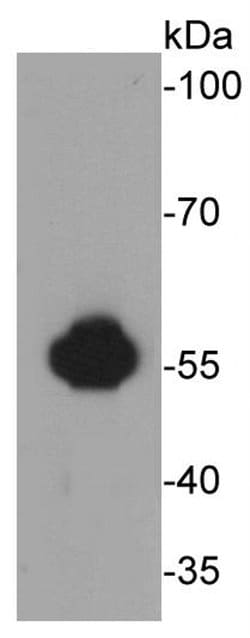 Invitrogen ALDH2 Monoclonal Antibody (E4-D10) 100 &mu;L; Unconjugated:Antibodies,