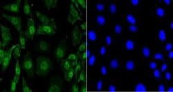 Invitrogen EFTUD2 Monoclonal Antibody (1-D10-A1) 100 &mu;L | Buy Online | Invitrogen&trade; | Fisher Scientific