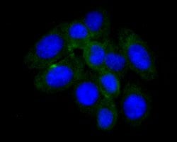 Invitrogen Haptoglobin Monoclonal Antibody (5-D3) 100 &mu;L; Unconjugated:Antibodies,