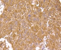 Invitrogen Haptoglobin Monoclonal Antibody (5-D3) 100 &mu;L; Unconjugated:Antibodies,
