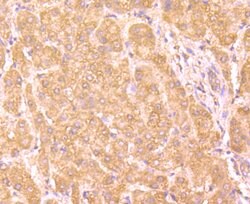 Invitrogen Haptoglobin Monoclonal Antibody (5-D3) 100 &mu;L; Unconjugated:Antibodies,