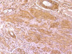 Invitrogen BLCAP Monoclonal Antibody (4E1) 100 &mu;L; Unconjugated:Antibodies,