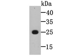 Invitrogen BLCAP Monoclonal Antibody (4E1) 100 &mu;L; Unconjugated:Antibodies,