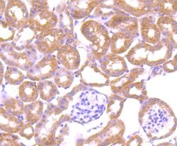 LRRK1 Monoclonal Antibody (5B1), Invitrogen 100 &mu;L; Unconjugated:Antibodies,