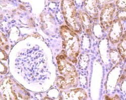 LRRK1 Monoclonal Antibody (5B1), Invitrogen 100 &mu;L; Unconjugated:Antibodies,