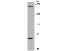 LRRK1 Monoclonal Antibody (5B1), Invitrogen 100 &mu;L; Unconjugated:Antibodies,