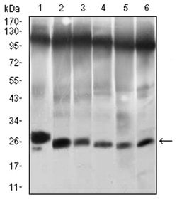 TWIST1 Monoclonal Antibody (3E1), Invitrogen 100 &mu;L; Unconjugated:Antibodies,