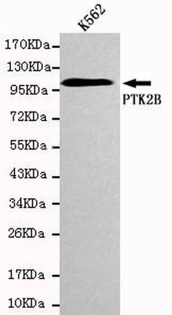 Invitrogen PYK2 Monoclonal Antibody (7A2) 100 &mu;L; Unconjugated:Antibodies,
