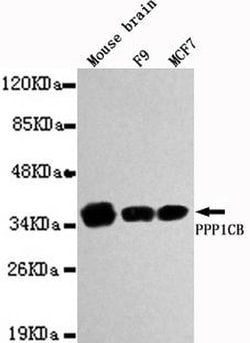 Invitrogen PP1 beta Recombinant Rabbit Monoclonal Antibody (2E9) 100 &mu;L;