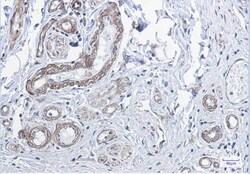 Invitrogen PP1 beta Recombinant Rabbit Monoclonal Antibody (2E9) 100 &mu;L;