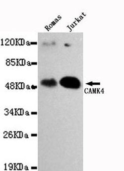 Invitrogen CaMKIV Monoclonal Antibody (7B8) 100 &mu;L; Unconjugated:Antibodies,