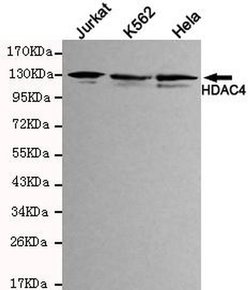 Invitrogen HDAC4 Monoclonal Antibody (5B2) 100 &mu;L; Unconjugated:Antibodies,
