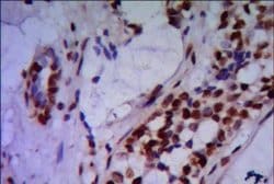 Invitrogen PRMT6 Monoclonal Antibody (7B11) 100 &mu;L; Unconjugated:Antibodies,