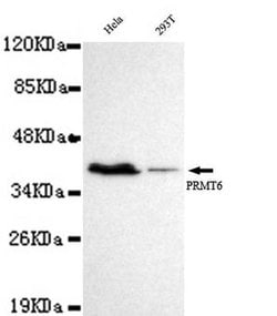 Invitrogen PRMT6 Monoclonal Antibody (7B11) 100 &mu;L; Unconjugated:Antibodies,