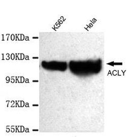 Invitrogen ATP Citrate Lyase Monoclonal Antibody (3A10) 100 &mu;L; Unconjugated:Antibodies,