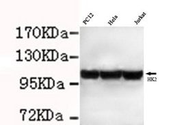 Invitrogen HK2 Monoclonal Antibody (7E7) 100 &mu;L; Unconjugated:Antibodies,