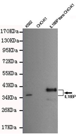 Invitrogen IL18BP Monoclonal Antibody (7C6) 100 &mu;L; Unconjugated:Antibodies,