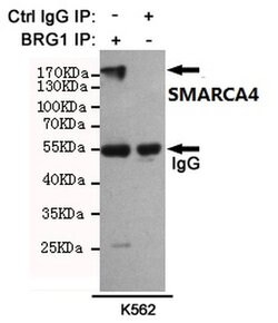 Invitrogen BRG1 Monoclonal Antibody (6D7) 100 &mu;L; Unconjugated:Antibodies,