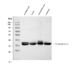 Invitrogen TPM1 Monoclonal Antibody (TM31) 100 &mu;g | Buy Online | Invitrogen&trade; | Fisher Scientific