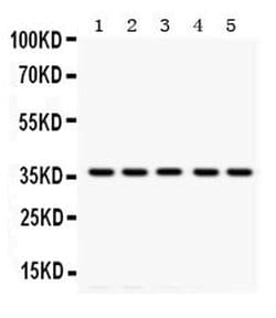 TPM4 Monoclonal Antibody (TM228), Invitrogen 100 &mu;g | Buy Online | Thermo Scientific | Fisher Scientific