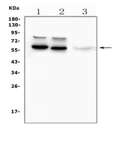 Tyrosine Hydroxylase Monoclonal Antibody (TH-16), Invitrogen 100 &mu;g;