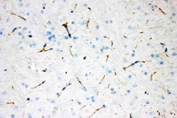 Tyrosine Hydroxylase Monoclonal Antibody (TH-16), Invitrogen 100 &mu;g;