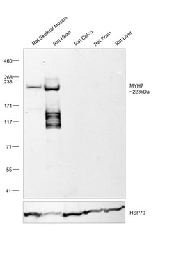 Invitrogen MYH7 Monoclonal Antibody (NOQ7.5.4D) 100 &mu;g; Unconjugated:Antibodies,