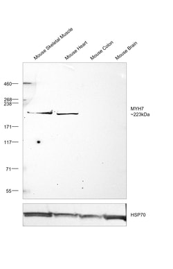 Invitrogen MYH7 Monoclonal Antibody (NOQ7.5.4D) 100 &mu;g; Unconjugated:Antibodies,