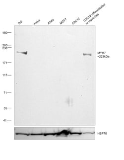 Invitrogen MYH7 Monoclonal Antibody (NOQ7.5.4D) 100 &mu;g; Unconjugated:Antibodies,